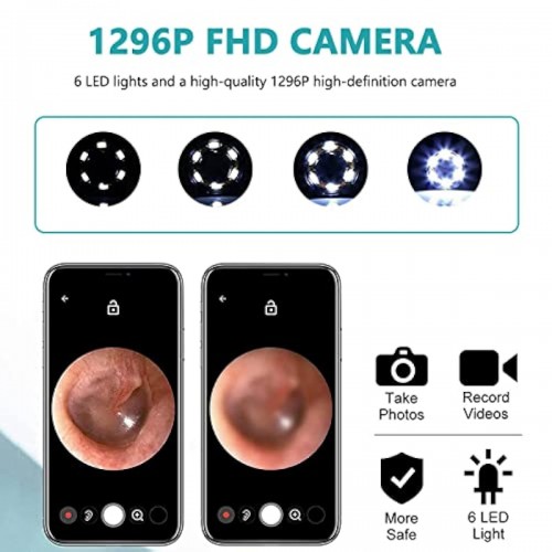 NE3pro Otoscope - 1080P HD Video, Elimination Spoon, High-Resolution Load Otoscope. image