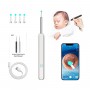 NE3pro Otoscope - 1080P HD Video, Elimination Spoon, High-Resolution Load Otoscope.