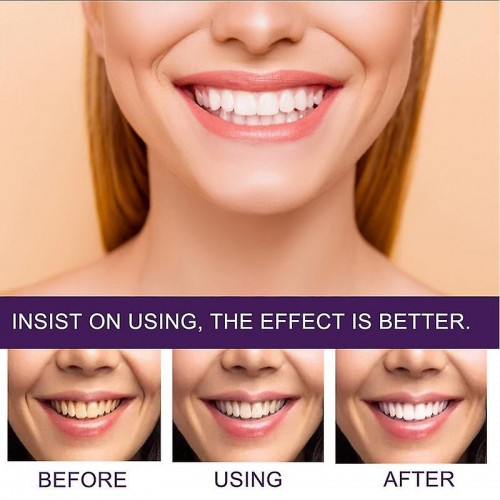Purple Toothpaste Teeth Color Corrector - Brighten and Correct Tooth Discoloration image