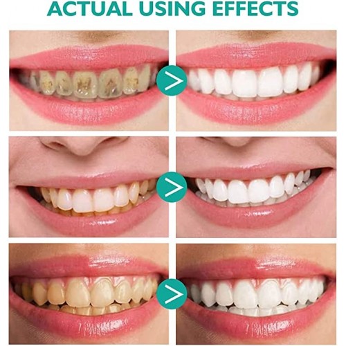 Teeth Whitening Mousse with Baking Soda - Brighten Your Smile Naturally image