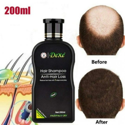 Dexe Herbal Anti Hair Loss Growth Unisex Shampoo - 200ml image