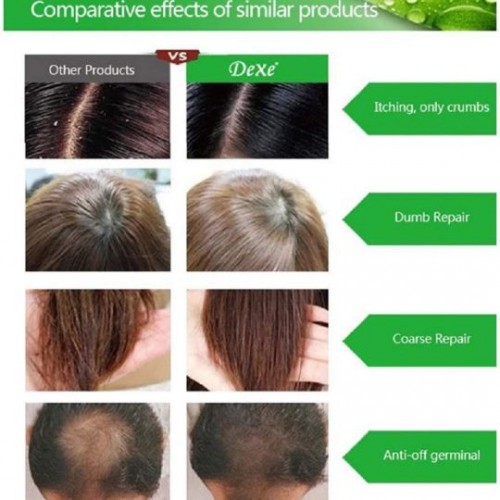 Dexe Herbal Anti Hair Loss Growth Unisex Shampoo - 200ml image