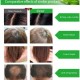 Dexe Herbal Anti Hair Loss Growth Unisex Shampoo - 200ml image