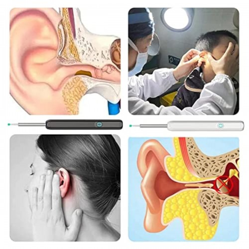 NE3pro Otoscope - 1080P HD Video, Elimination Spoon, High-Resolution Load Otoscope. image