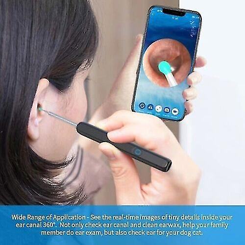 NE3pro Otoscope - 1080P HD Video, Elimination Spoon, High-Resolution Load Otoscope. image