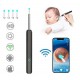 NE3pro Otoscope - 1080P HD Video, Elimination Spoon, High-Resolution Load Otoscope. image