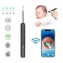 NE3pro Otoscope - 1080P HD Video, Elimination Spoon, High-Resolution Load Otoscope.