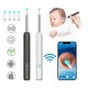 NE3pro Otoscope - 1080P HD Video, Elimination Spoon, High-Resolution Load Otoscope. image