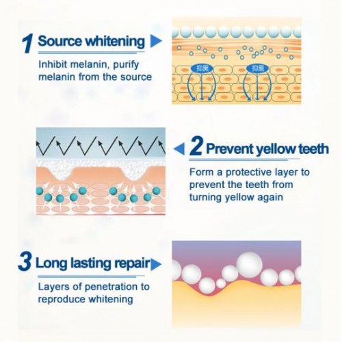 Teeth Whitening Gel Pen Home & Travel Stain Removal Solution image